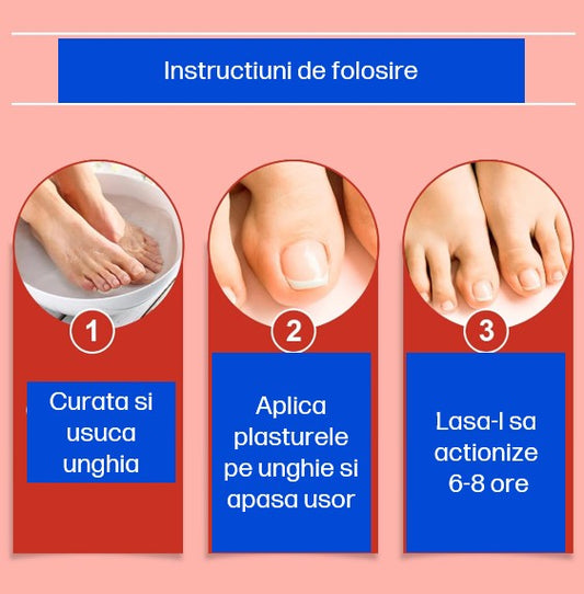 Plasturele pentru ciuperca unghiei